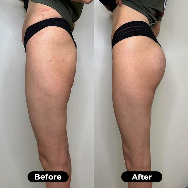 Bikenda® StrengthenUP EMS Glute & Thigh Trainer