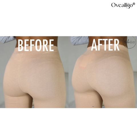 Oveallgo® Booty Shaping Patch
