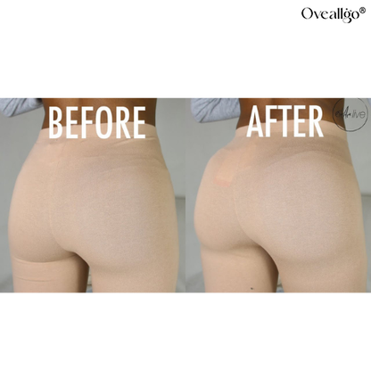 Oveallgo® Booty Shaping Patch